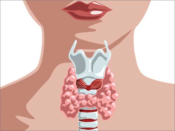 Thyroid Diseases